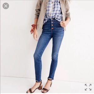 10 inch button front